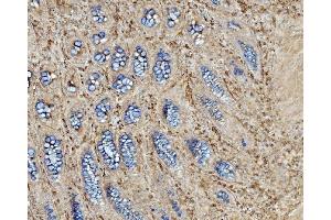 IHC analysis of EHD3 using anti-EHD3 antibody (ABIN7602777). (EHD3 anticorps  (C-Term))