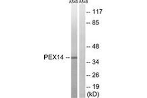 Western blot analysis of extracts from A549 cells, using PEX14 Antibody. (PEX14 anticorps  (AA 117-166))