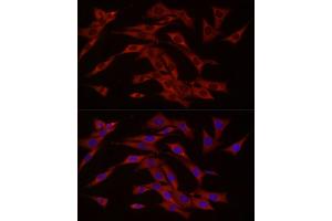 Immunofluorescence analysis of NIH/3T3 cells using cGAS Rabbit pAb (ABIN6134073, ABIN6143590, ABIN6143591 and ABIN6224360) at dilution of 1:50 (40x lens).