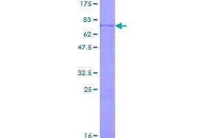 Image no. 1 for NADH Dehydrogenase (Ubiquinone) Flavoprotein 1, 51kDa (NDUFV1) (AA 1-464) protein (GST tag) (ABIN1312297)