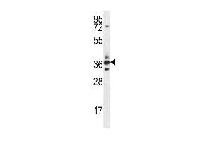 SFRP5 Antibody (Center) (ABIN656890 and ABIN2846089) western blot analysis in mouse heart tissue lysates (35 μg/lane).