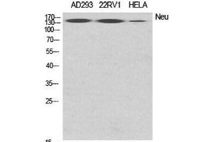 Western Blot analysis of various cells using ERBB2 Polyclonal Antibody at dilution of 1:2000. (ErbB2/Her2 anticorps)