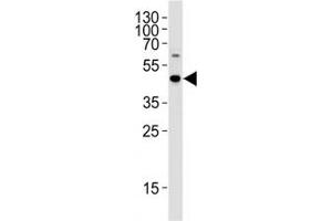 C9orf72 antibody western blot analysis in WiDr cell lysate
