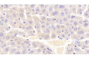 Detection of VAV1 in Mouse Liver Tissue using Polyclonal Antibody to Vav 1 Oncogene (VAV1) (VAV1 anticorps  (AA 565-795))