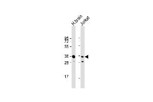 All lanes : Anti-GNB1 Antibody (N-term) at 1:1000 dilution Lane 1: human brain lysate Lane 2: Jurkat whole cell lysate Lysates/proteins at 20 μg per lane. (GNB1 anticorps  (N-Term))
