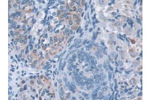 IHC-P analysis of Mouse Ovary Tissue, with DAB staining. (IQGAP1 anticorps  (AA 1276-1657))