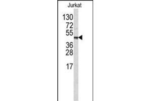 Western blot analysis of CPB2 antibody (Center ) (ABIN390451 and ABIN2840825) in Jurkat cell line lysates (35 μg/lane). (CPB2 anticorps  (AA 119-148))