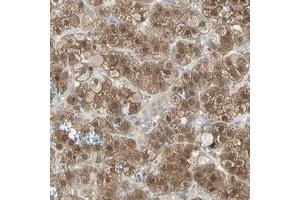 Immunohistochemical staining of human adrenal gland with LHPP polyclonal antibody  shows strong cytoplasmic positivity in cortical cells at 1:200-1:500 dilution.
