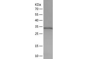 Western Blotting (WB) image for Tropomyosin 3 (TPM3) (AA 6-246) protein (His tag) (ABIN7125505)
