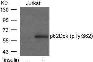 Western blot analysis of extracts from Jurkat cells untreated or treated with insulin using p62Dok(phospho-Tyr362) Antibody. (DOK1 anticorps  (pTyr362))