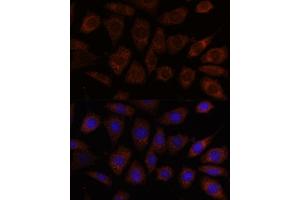 anti-SEC24 Family, Member D (S. Cerevisiae) (SEC24D) (AA 830-1000) antibody