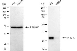 Western blotting analysis using PRKRA antibody (ABIN7800015). (Recombinant PRKRA anticorps)