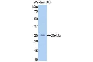 WB of Protein Standard: different control antibodies against Highly purified E.