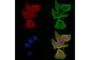 ABIN7095380 and ABIN7099437 staining Hela cells(45 min of heat-shock treatment) by IF/ICC. (VKORC1L1 anticorps)