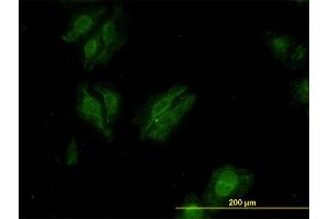 Immunofluorescence of monoclonal antibody to KSR2 on HeLa cell. (KSR2 anticorps  (AA 411-500))