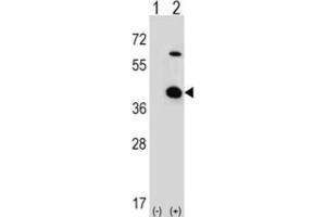 Western Blotting (WB) image for anti-Serine/threonine Kinase Receptor Associated Protein (STRAP) antibody (ABIN3001728) (STRAP anticorps)