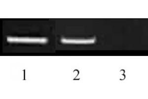 Histone H3 dimethyl Lys9 antibody tested by ChIP. (Histone 3 anticorps  (H3K9me2))