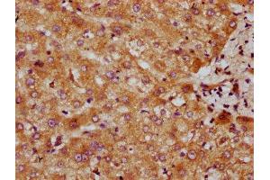 IHC image of ABIN7147604 diluted at 1:300 and staining in paraffin-embedded human liver tissue performed on a Leica BondTM system. (CYP7A1 anticorps  (AA 303-423))