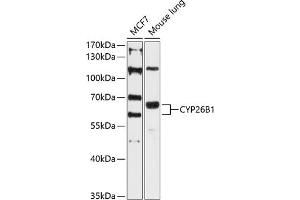 Western blot analysis of extracts of various cell lines, using CYP26B1 antibody (ABIN6130158, ABIN6139325, ABIN6139326 and ABIN6215727) at 1:3000 dilution.