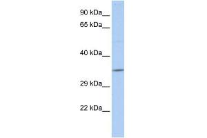 WB Suggested Anti-SCAND2 Antibody Titration:  0. (SCAND2 anticorps  (N-Term))