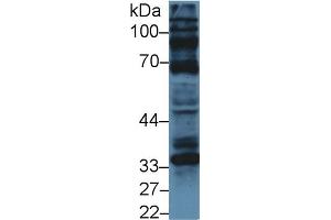 Western Blot; Sample: Human U87MG cell lysate; Primary Ab: 5µg/ml Rabbit Anti-Bovine CCND1 Antibody Second Ab: 0. (Cyclin D1 anticorps  (AA 72-272))