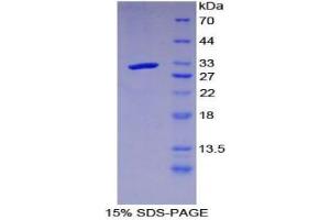 SDS-PAGE analysis of Mouse LRIG3 Protein. (LRIG3 Protéine)