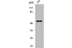 Western Blot analysis of 293 cells using Dematin Polyclonal Antibody