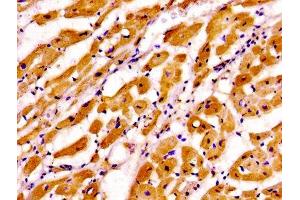 Immunohistochemistry of paraffin-embedded human heart tissue using ABIN7173574 at dilution of 1:100 (TNNI3 anticorps  (AA 2-210))