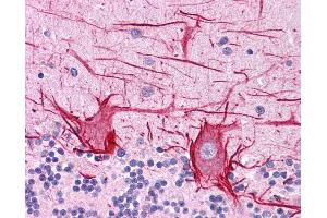 ApoB antibody was used for immunohistochemistry at a concentration of 4-8 ug/ml. (APOB anticorps  (Middle Region))