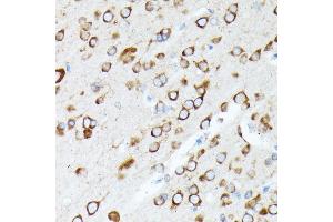 Immunohistochemistry of paraffin-embedded rat brain using RPL7 antibody (ABIN6128656, ABIN6147148, ABIN6147149 and ABIN6221631) at dilution of 1:100 (40x lens).
