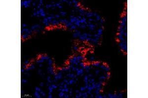 Immunofluorescence of paraffin embedded mouse lung+LPS using MADCAM1 (ABIN7074695) at dilution of 1:1800 (400x lens) (MADCAM1 anticorps)