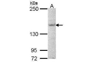 WB Image Sample (30 ug of whole cell lysate) A: NT2D1 5% SDS PAGE antibody diluted at 1:1000 (AHI1 anticorps  (N-Term))