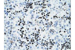 Image no. 1 for anti-Influenza Virus NS1A Binding Protein (IVNS1ABP) (AA 47-96) antibody (ABIN6735955)