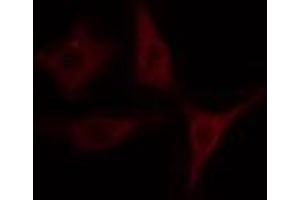 ABIN6274507 staining COLO205 cells by IF/ICC. (SLK anticorps  (C-Term))