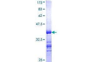 Image no. 1 for Baculoviral IAP Repeat-Containing 8 (BIRC8) (AA 127-236) protein (GST tag) (ABIN1346702)