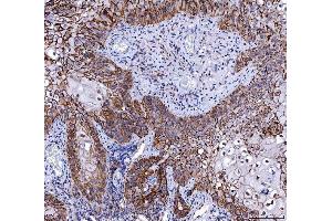 IHC analysis of CD147/Emmprin using anti-CD147/Emmprin antibody (ABIN7599998).