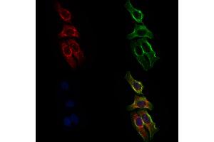 ABIN6258793 and ABIN6275993 staining Hela cells by IF/ICC. (FZD8 anticorps  (N-Term))