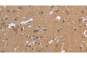 Immunohistochemistry of paraffin-embedded Human brain tissue using KIAA1324 Polyclonal Antibody at dilution 1:30