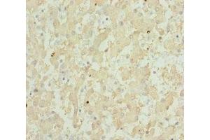 Immunohistochemistry of paraffin-embedded human liver tissue using ABIN7151911 at dilution of 1:100