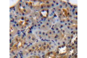 Used in DAB staining on fromalin fixed paraffin-embedded kidney tissue