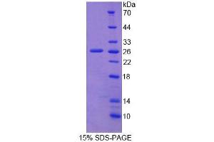 SDS-PAGE (SDS) image for Fibulin 2 (FBLN2) (AA 858-1069) protein (His tag) (ABIN1099083) (FBLN2 Protein (AA 858-1069) (His tag))