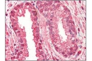 Immunohistochemistry (IHC) image for anti-Cathepsin L1 (CTSL1) (AA 114-333) antibody (ABIN317508) (Cathepsin L anticorps  (AA 114-333))