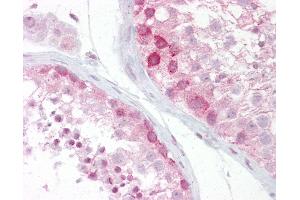 Anti-WNT2B antibody IHC of human testis.