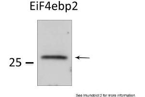 Sample Type: HEK 293 cells (50ug)Primary Dilution: 1:1000Image Submitted by: Veronique DorvalLaval University, Canada . (eIF4EBP2 anticorps  (N-Term))