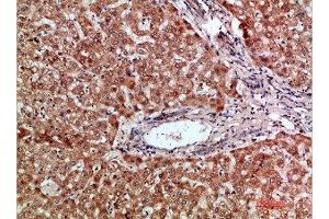 Immunohistochemical analysis of paraffin-embedded human-liver, antibody was diluted at 1:200
