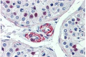 Human Testis: Formalin-Fixed, Paraffin-Embedded (FFPE)