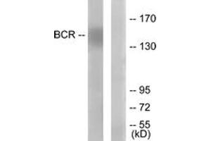 Western blot analysis of extracts from K562 cells, using Bcr (Ab-177) Antibody. (BCR anticorps  (AA 144-193))