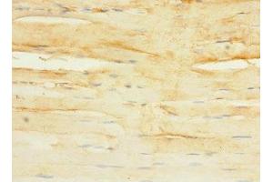 Immunohistochemistry of paraffin-embedded human skeletal muscle tissue using ABIN7166580 at dilution of 1:100