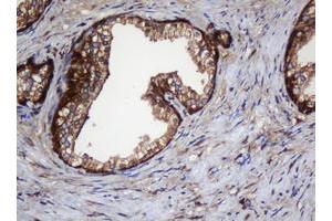 Image no. 7 for anti-SERPINE1 mRNA Binding Protein 1 (SERBP1) (AA 1-262) antibody (ABIN1490675)