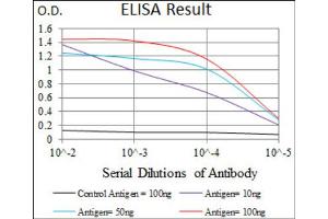 Immunohistochemical analysis of paraffin-embedded rectum cancer tissues using ALDH2 antibody with DAB staining.